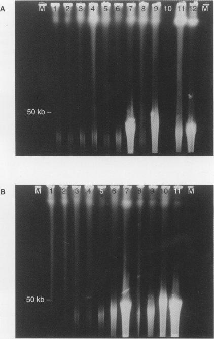 https://cdn.ncbi.nlm.nih.gov/pmc/blobs/4419/2151273/2b780315474e/brjcancer00077-0049-b.jpg
