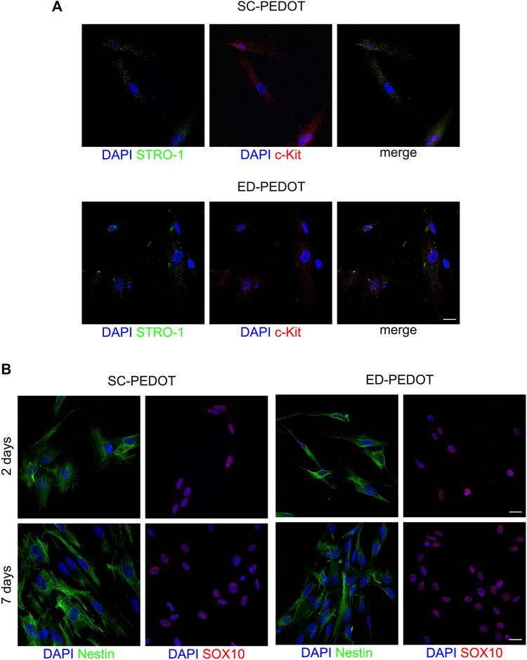 https://cdn.ncbi.nlm.nih.gov/pmc/blobs/441a/9428488/e7bc5764b3ea/fphys-13-930804-g004.jpg