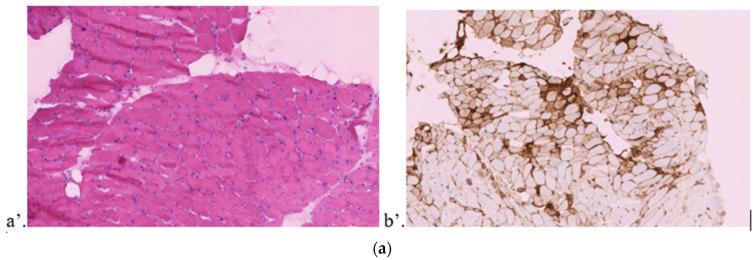 https://cdn.ncbi.nlm.nih.gov/pmc/blobs/441c/9573481/228b7a37f39b/jcm-11-05611-g001a.jpg