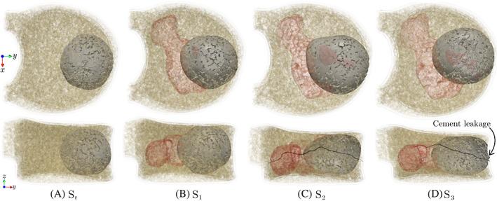 https://cdn.ncbi.nlm.nih.gov/pmc/blobs/441d/9287026/f08b092b577a/CNM-38-0-g007.jpg