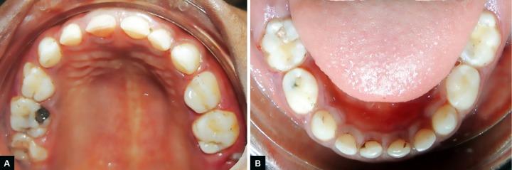 https://cdn.ncbi.nlm.nih.gov/pmc/blobs/4425/6212666/5e4481c32f3e/ijcpd-11-344-g001.jpg