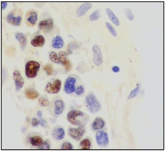 https://cdn.ncbi.nlm.nih.gov/pmc/blobs/4426/9658079/80ec1d0d72cb/cancers-14-05458-g005.jpg