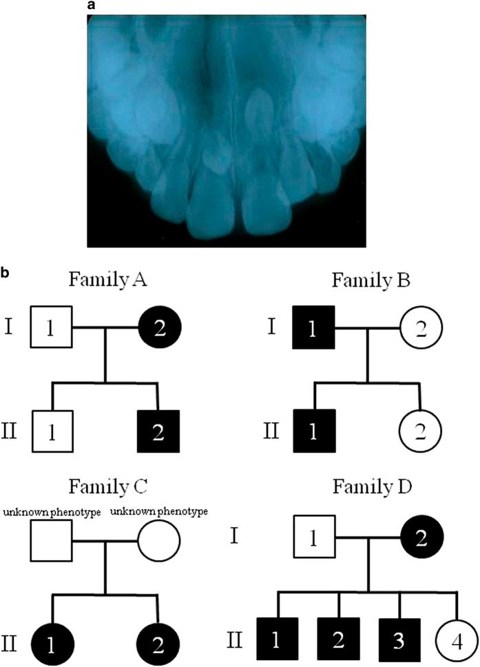 https://cdn.ncbi.nlm.nih.gov/pmc/blobs/442d/5267165/4228e3952616/hgv201646-f1.jpg