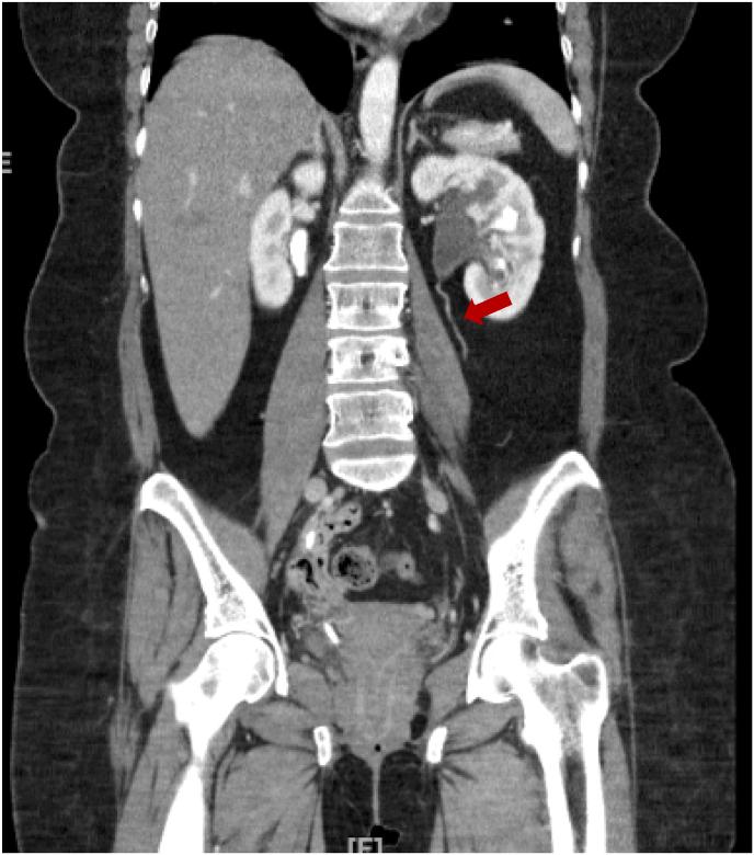 https://cdn.ncbi.nlm.nih.gov/pmc/blobs/4430/11047787/21dae9e9e705/gr1.jpg