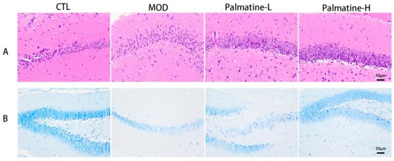 https://cdn.ncbi.nlm.nih.gov/pmc/blobs/4432/10745955/0ec856a2ebb1/molecules-28-07955-g005.jpg