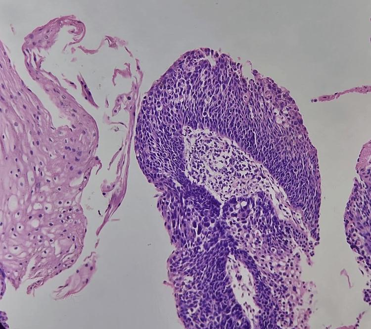 https://cdn.ncbi.nlm.nih.gov/pmc/blobs/4438/11143767/67a610592ecc/cureus-0016-00000059508-i06.jpg