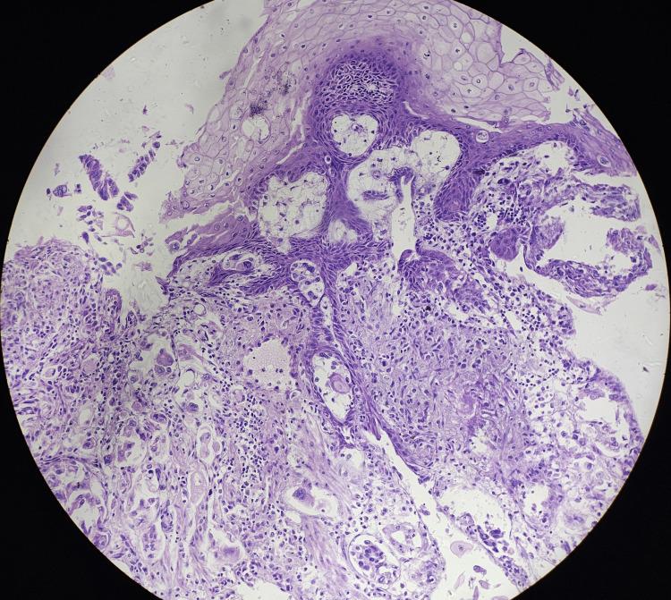 https://cdn.ncbi.nlm.nih.gov/pmc/blobs/4438/11143767/bda837091f86/cureus-0016-00000059508-i07.jpg