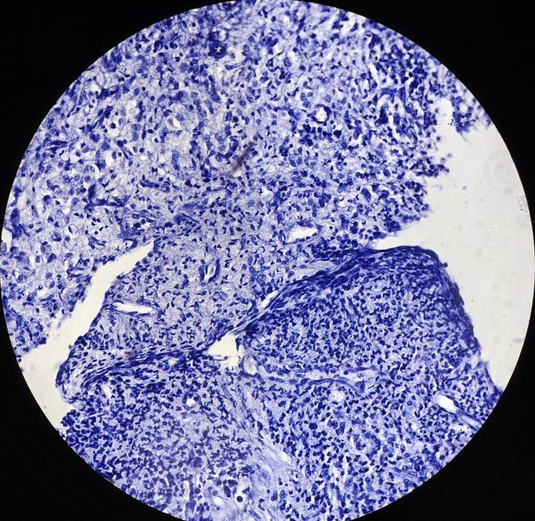 https://cdn.ncbi.nlm.nih.gov/pmc/blobs/4438/11143767/be900d279ca2/cureus-0016-00000059508-i09.jpg