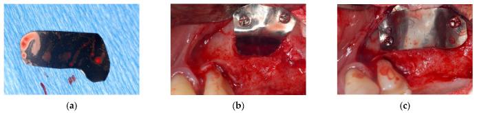 https://cdn.ncbi.nlm.nih.gov/pmc/blobs/4439/8587813/6f81236fd47e/materials-14-06642-g002.jpg
