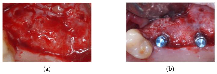 https://cdn.ncbi.nlm.nih.gov/pmc/blobs/4439/8587813/7533d2b3d2fd/materials-14-06642-g003.jpg
