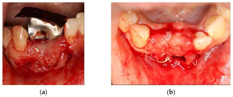https://cdn.ncbi.nlm.nih.gov/pmc/blobs/4439/8587813/9fa8a7a449c2/materials-14-06642-g016.jpg