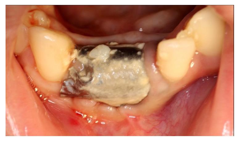 https://cdn.ncbi.nlm.nih.gov/pmc/blobs/4439/8587813/fd021cf8d876/materials-14-06642-g015.jpg