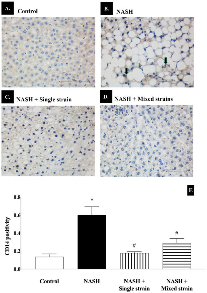 https://cdn.ncbi.nlm.nih.gov/pmc/blobs/443a/11605219/ad9c6fdfa775/biomedicines-12-01847-g004.jpg