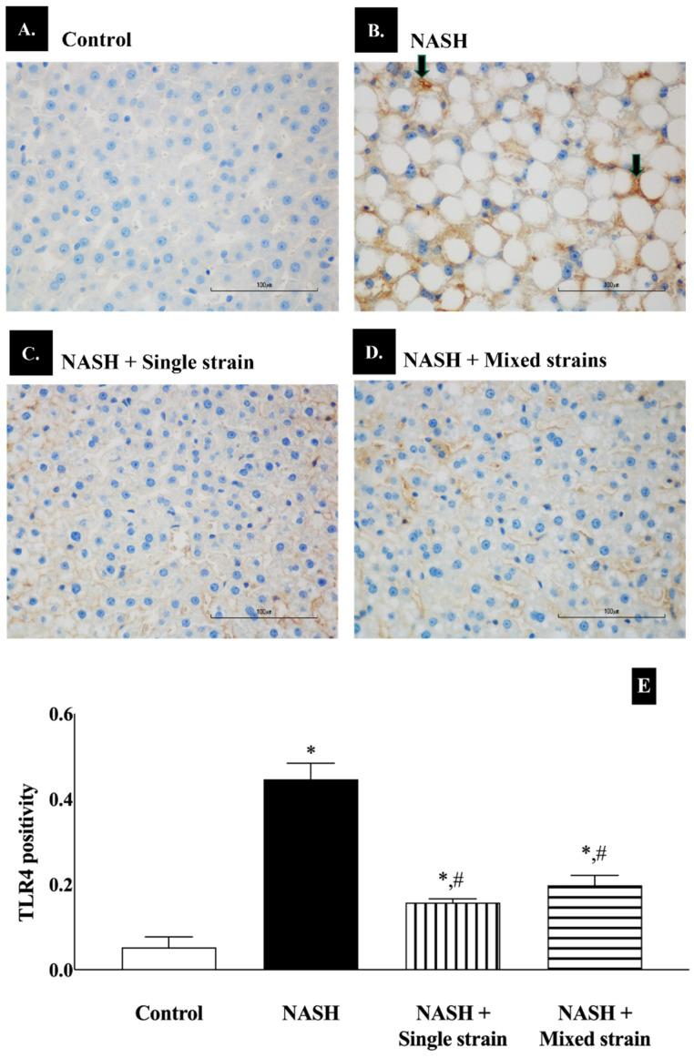 https://cdn.ncbi.nlm.nih.gov/pmc/blobs/443a/11605219/d4f487dd4d3c/biomedicines-12-01847-g005.jpg