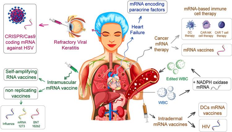 https://cdn.ncbi.nlm.nih.gov/pmc/blobs/444d/12179814/b0ff994261c0/cureus-0017-00000084529-i05.jpg