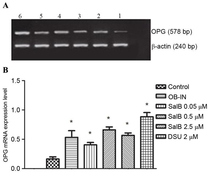 https://cdn.ncbi.nlm.nih.gov/pmc/blobs/444d/5615234/86ff94613386/etm-14-04-2779-g02.jpg
