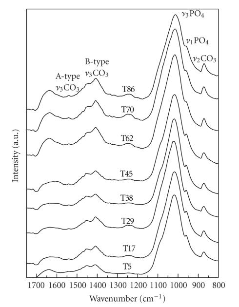 https://cdn.ncbi.nlm.nih.gov/pmc/blobs/4450/2814098/b67f1a3dfebd/IJBM2009-698547.008.jpg