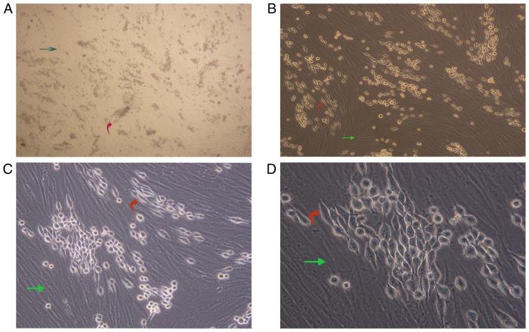 https://cdn.ncbi.nlm.nih.gov/pmc/blobs/445c/6667869/ee96cd4a76c8/or-42-03-1035-g01.jpg