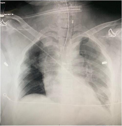 https://cdn.ncbi.nlm.nih.gov/pmc/blobs/445e/10629870/acb746f5cf6e/rjad606f1.jpg