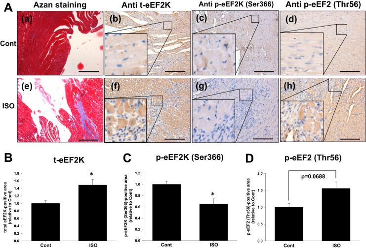https://cdn.ncbi.nlm.nih.gov/pmc/blobs/445f/5613342/1461ef04e507/gr4.jpg