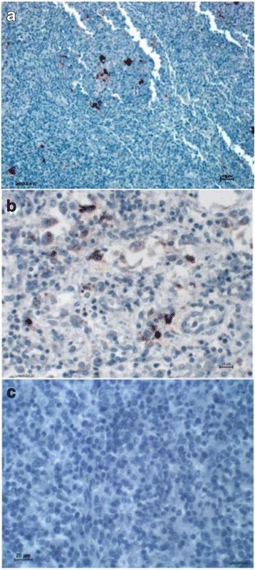 https://cdn.ncbi.nlm.nih.gov/pmc/blobs/446d/5772722/8e88f831bb66/40813_2017_77_Fig5_HTML.jpg