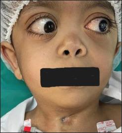 https://cdn.ncbi.nlm.nih.gov/pmc/blobs/4470/10697276/12c3babae42f/OJO-16-537-g002.jpg