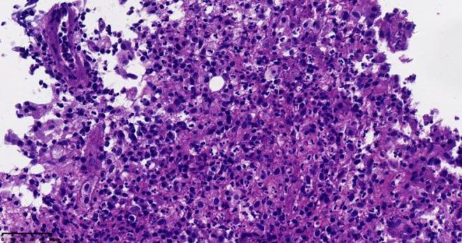 https://cdn.ncbi.nlm.nih.gov/pmc/blobs/4473/11410870/2b1ebdb790c4/CCR3-12-e9446-g003.jpg