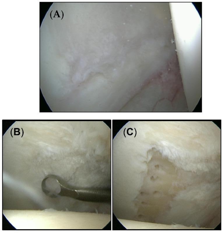 https://cdn.ncbi.nlm.nih.gov/pmc/blobs/447e/9658426/b151099415fc/jcm-11-06283-g001.jpg