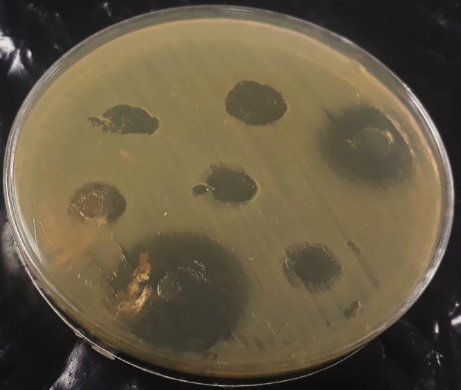 https://cdn.ncbi.nlm.nih.gov/pmc/blobs/4484/7395952/8bde17b8fdb4/IJMS-45-298-g002.jpg