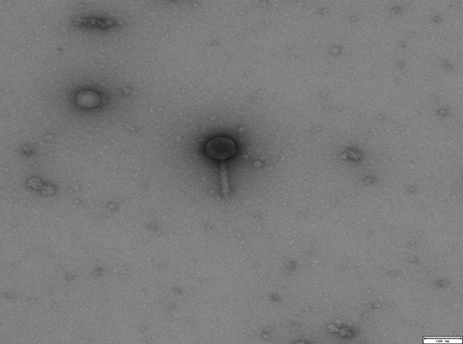 https://cdn.ncbi.nlm.nih.gov/pmc/blobs/4484/7395952/eb1a7719b3f8/IJMS-45-298-g003.jpg