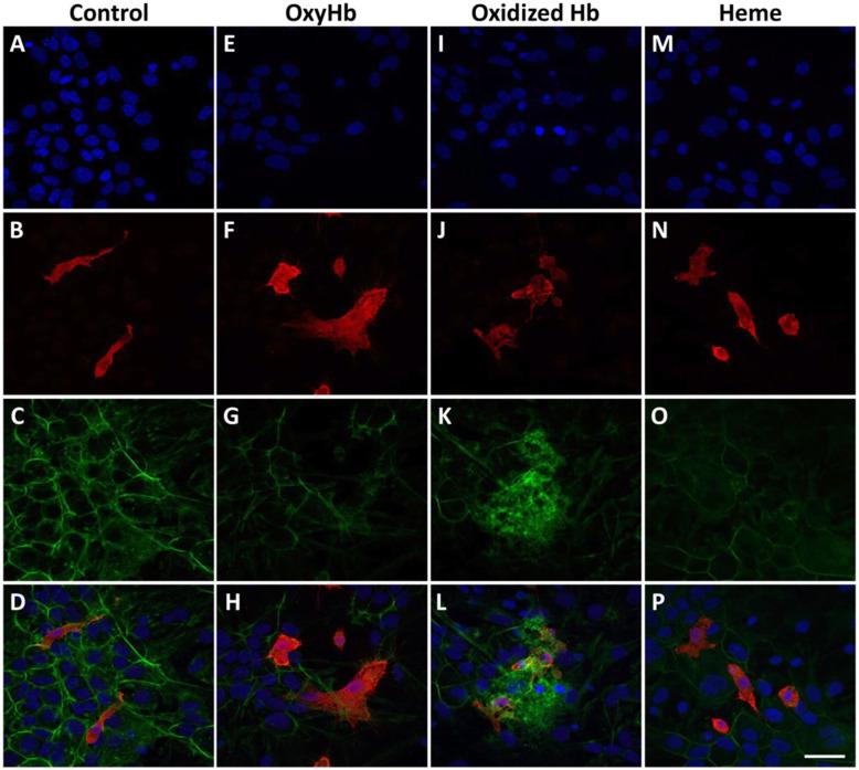 https://cdn.ncbi.nlm.nih.gov/pmc/blobs/4498/7879625/2d99dcc09ffc/12974_2020_2052_Fig2_HTML.jpg