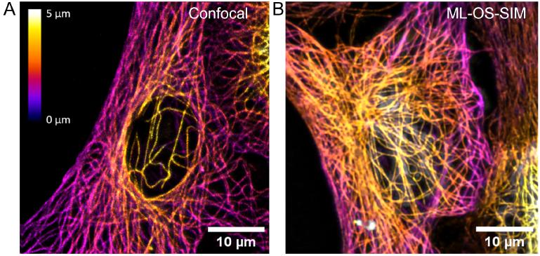 https://cdn.ncbi.nlm.nih.gov/pmc/blobs/449f/10890859/10056a816637/boe-15-2-1074-g008.jpg