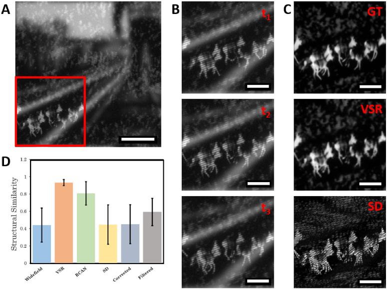 https://cdn.ncbi.nlm.nih.gov/pmc/blobs/449f/10890859/87748667d374/boe-15-2-1074-g006.jpg