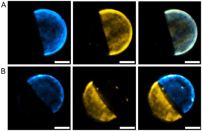 https://cdn.ncbi.nlm.nih.gov/pmc/blobs/449f/10890859/fdfad76a7915/boe-15-2-1074-g010.jpg