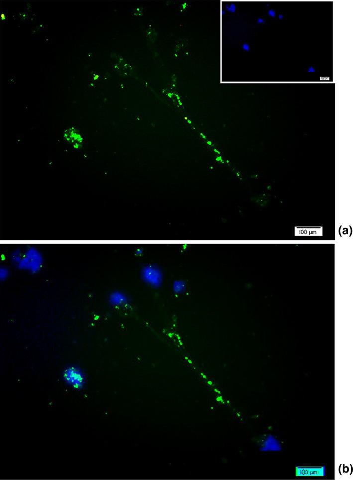 https://cdn.ncbi.nlm.nih.gov/pmc/blobs/449f/7559618/dc59005e1857/BRB3-10-e01799-g005.jpg