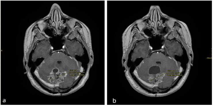 https://cdn.ncbi.nlm.nih.gov/pmc/blobs/44a1/8025816/873ff1455e19/curroncol-28-00121-g001.jpg