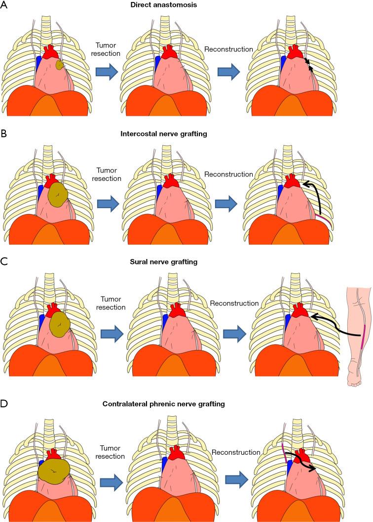 https://cdn.ncbi.nlm.nih.gov/pmc/blobs/44a5/12260954/5956f77b9461/med-09-15-f1.jpg