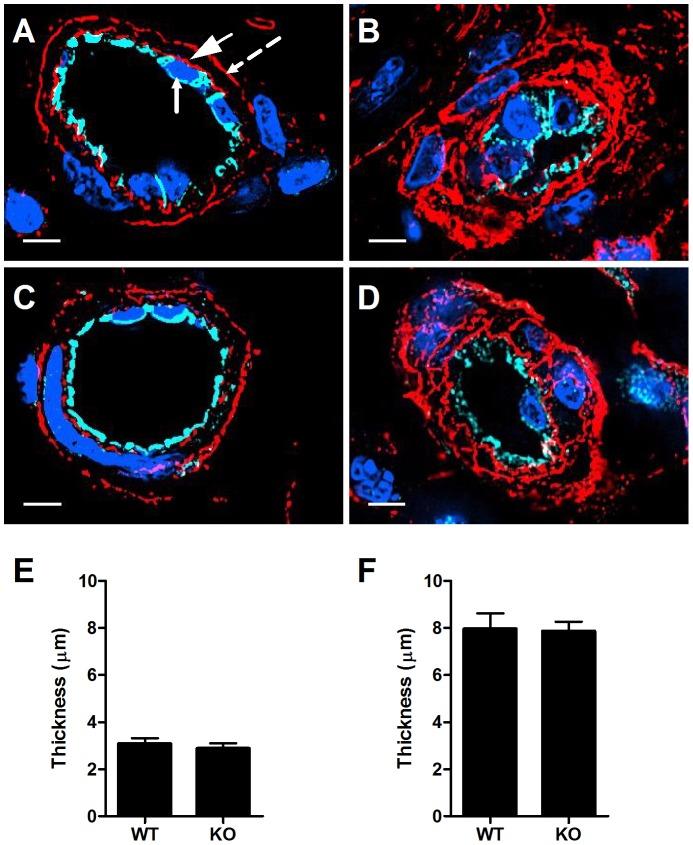https://cdn.ncbi.nlm.nih.gov/pmc/blobs/44a6/3899079/c3e6d1b537da/pone.0085699.g005.jpg