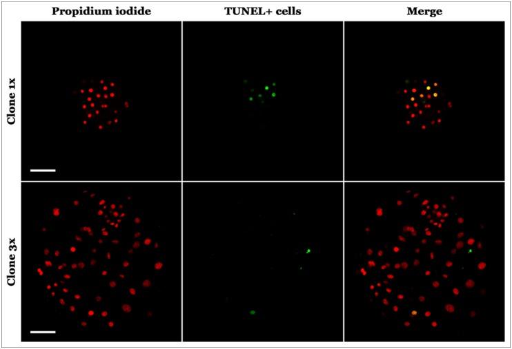 https://cdn.ncbi.nlm.nih.gov/pmc/blobs/44a6/4760708/74b875dff0aa/pone.0146390.g003.jpg