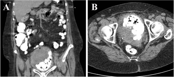 https://cdn.ncbi.nlm.nih.gov/pmc/blobs/44a8/3848612/9ba50721d497/1756-0500-6-354-1.jpg