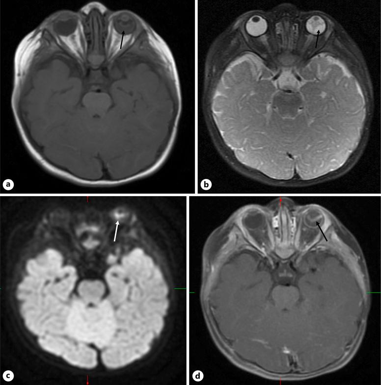https://cdn.ncbi.nlm.nih.gov/pmc/blobs/44b6/12136566/422b324ac0a9/cop-2025-0016-0001-545924_F02.jpg
