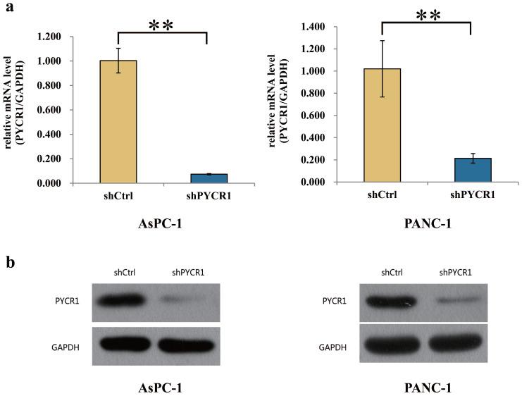 https://cdn.ncbi.nlm.nih.gov/pmc/blobs/44bf/8965111/6b9f2819fe12/jcav13p1501g003.jpg