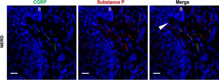 https://cdn.ncbi.nlm.nih.gov/pmc/blobs/44c4/10904498/6a872b3bca16/535_2023_2065_Fig2_HTML.jpg