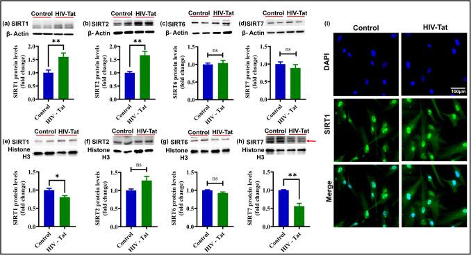 https://cdn.ncbi.nlm.nih.gov/pmc/blobs/44c9/12289736/8bf5fc9183ff/12035_2025_4885_Fig5_HTML.jpg