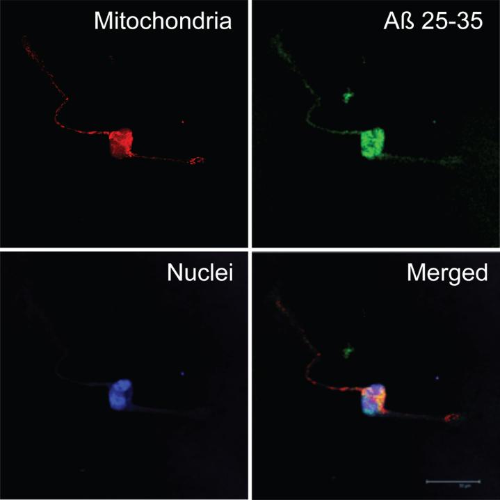 https://cdn.ncbi.nlm.nih.gov/pmc/blobs/44cb/5115610/ec564449cbb5/jad-55-jad160346-g004.jpg