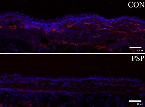 https://cdn.ncbi.nlm.nih.gov/pmc/blobs/44cd/2751803/9ef249001aa8/mv-v15-1951-f3.jpg