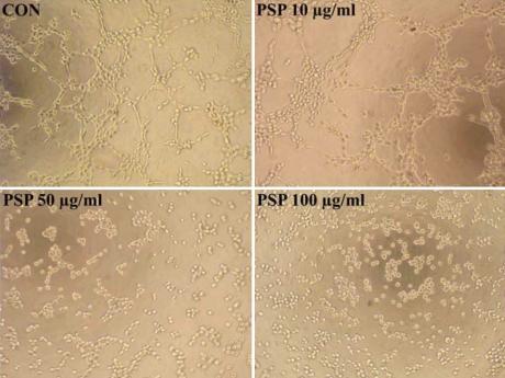 https://cdn.ncbi.nlm.nih.gov/pmc/blobs/44cd/2751803/cbe11a3c791d/mv-v15-1951-f8.jpg