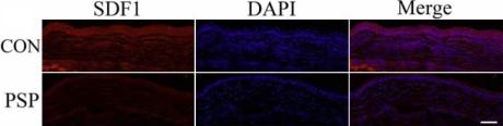 https://cdn.ncbi.nlm.nih.gov/pmc/blobs/44cd/2751803/dff090a5618d/mv-v15-1951-f4.jpg