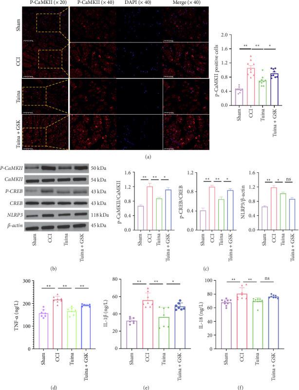 https://cdn.ncbi.nlm.nih.gov/pmc/blobs/44d3/12350020/567f3682aa0c/PRM2025-3697374.007.jpg