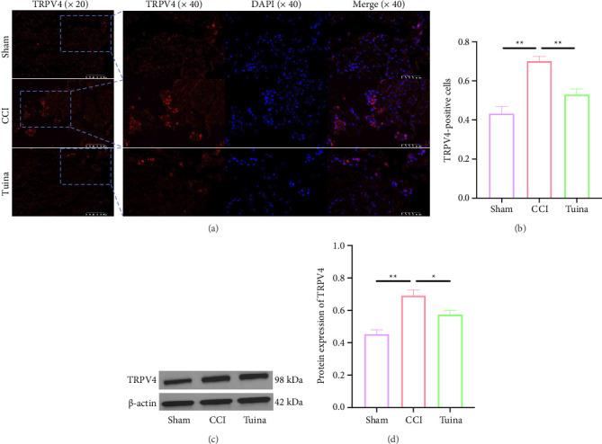 https://cdn.ncbi.nlm.nih.gov/pmc/blobs/44d3/12350020/7a932c029cb5/PRM2025-3697374.004.jpg
